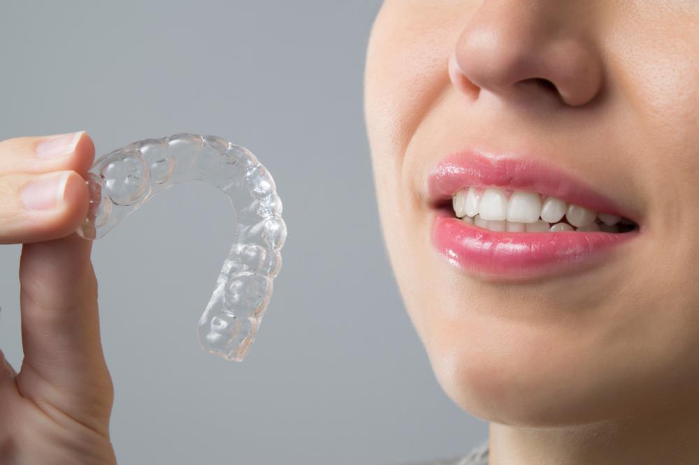 Cheapest Teeth Aligners UK | Tower House Dental Clinic